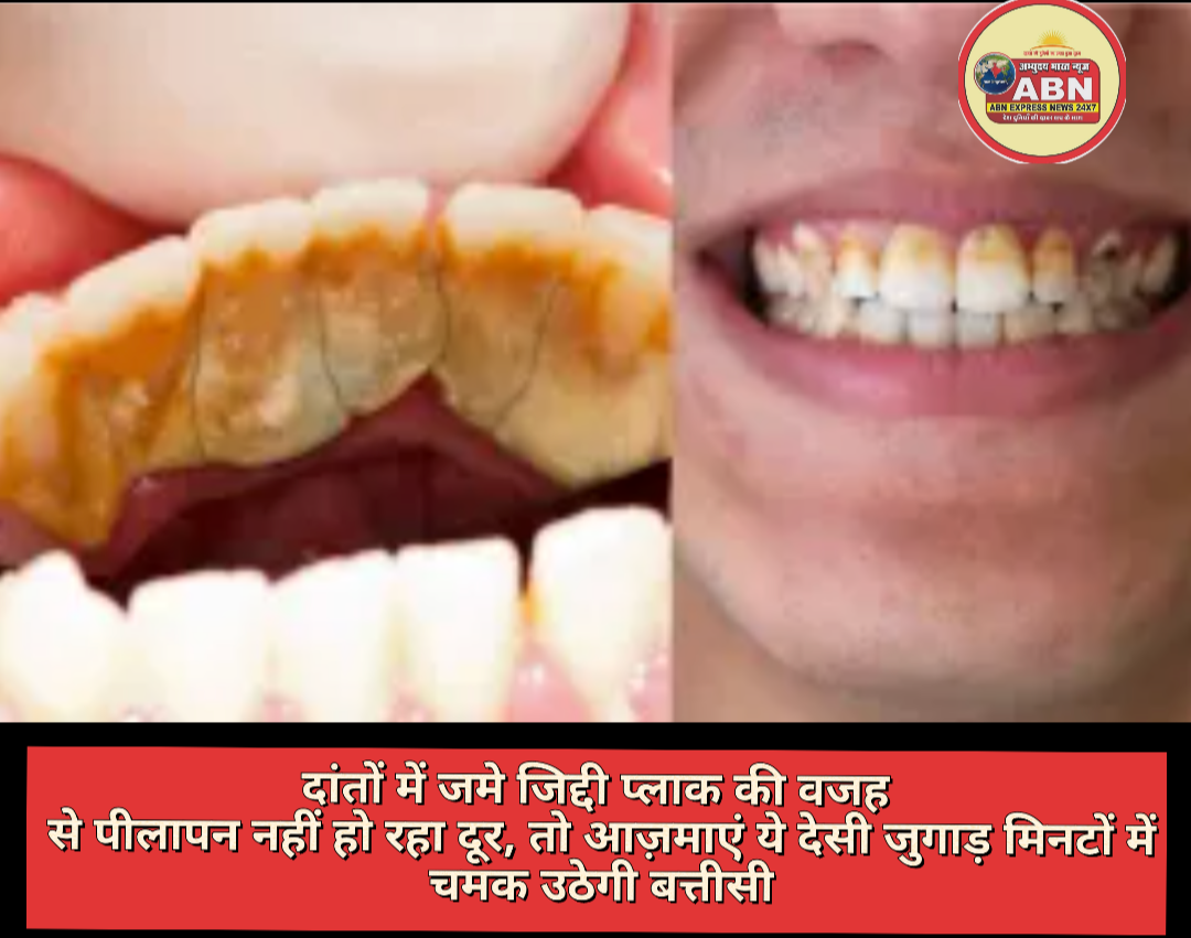 दांतों में जमे जिद्दी प्लाक की वजह से पीलापन नहीं हो रहा दूर, तो आज़माएं ये देसी जुगाड़ मिनटों में चमक उठेगी बत्तीसी